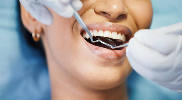 Best Emergency Tooth Extraction  in Weaverville, CA