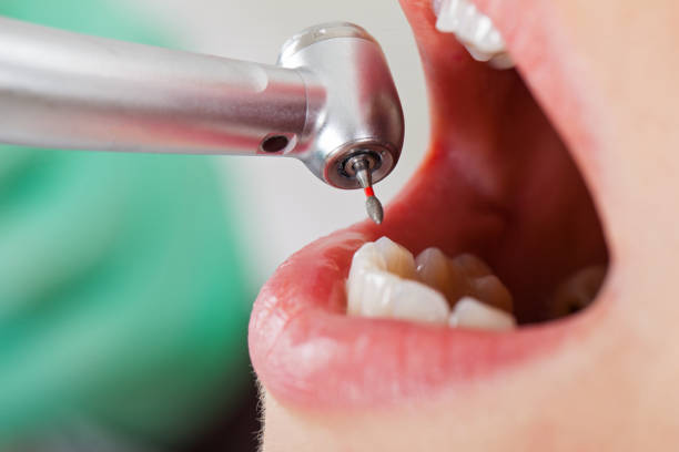 Best Dentist for Tooth Abscess  in Weaverville, CA
